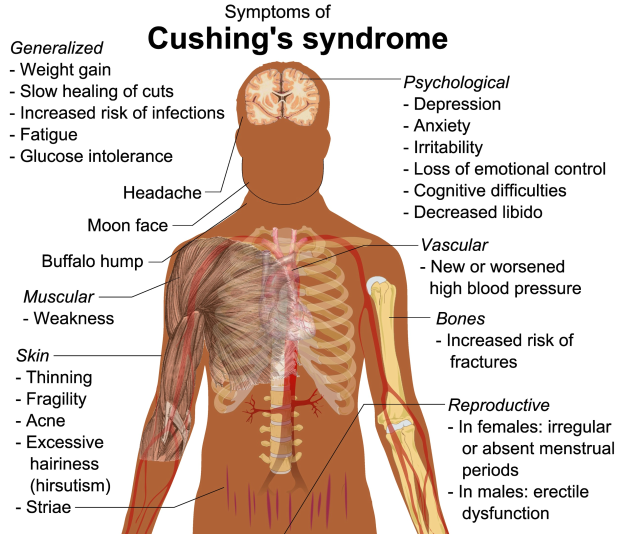 Plakat mit dem Titel "Symptome von Cushing-Syndrom" mit einer Menschendiagrammdarstellung, die Symptome wie Müdigkeit und Kopfschmerzen hervorhebt.